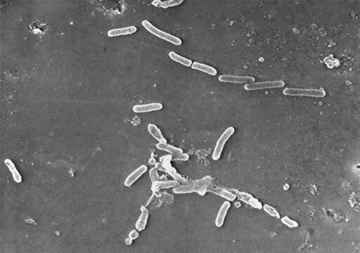 This scanning electron microscope image made available by the Centers for Disease Control and Prevention shows rod-shaped Pseudomonas aeruginosa bacteria. Experts are marveling at how U.S. disease detectives figured out how eyedrops were linked to dozens of infections. (Janice Haney Carr/CDC via AP)