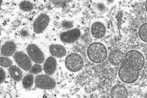 This 2003 electron microscope image made available by the Centers for Disease Control and Prevention shows mature, oval-shaped monkeypox virions, left, and spherical immature virions, right, obtained from a sample of human skin associated with the 2003 prairie dog outbreak. The World Health Organization said Friday, May 27, 2022, that nearly 200 cases of monkeypox have been reported in more than 20 countries not usually known to have outbreaks of the unusual disease. (Cynthia S. Goldsmith, Russe