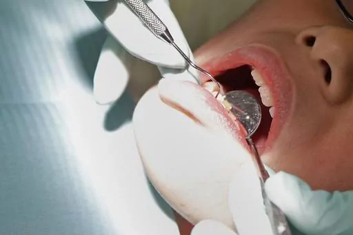 In this Friday, Jan. 22, 2016 photo, a dentist checks the teeth of a patient in Indianapolis. On Friday, April 21, 2023, The Associated Press reported on stories circulating online incorrectly claiming the No. 1 cause of heart attacks is a tooth treated for a root canal. (AP Photo/Michael Conroy, File)