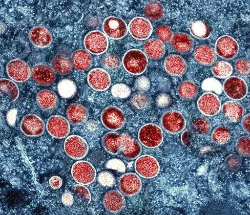 This image provided by the National Institute of Allergy and Infectious Diseases (NIAID) shows a colorized transmission electron micrograph of monkeypox particles (red) found within an infected cell (blue), cultured in the laboratory that was captured and color-enhanced at the NIAID Integrated Research Facility (IRF) in Fort Detrick, Md. On Friday, Aug. 12, 2022, The Associated Press reported on stories circulating online incorrectly claiming that monkeypox hasn't been detected in Georgia drinki
